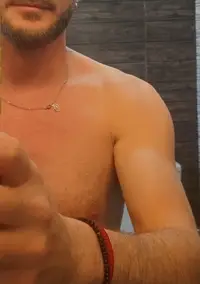 Foto 1 de 4