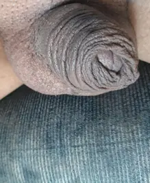 Foto 5 de 6
