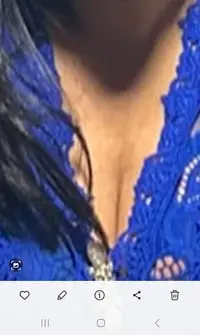 Foto 2 de 2
