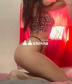 Foto 1 de 3