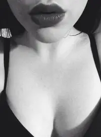 Foto 1 de 3