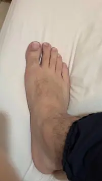 Foto 2 de 10