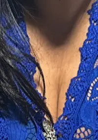 Foto 2 de 2